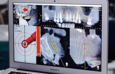 Imagen de pantalla de computadora con radiografías dentales, herramienta clave en la planificación de tratamientos odontológicos